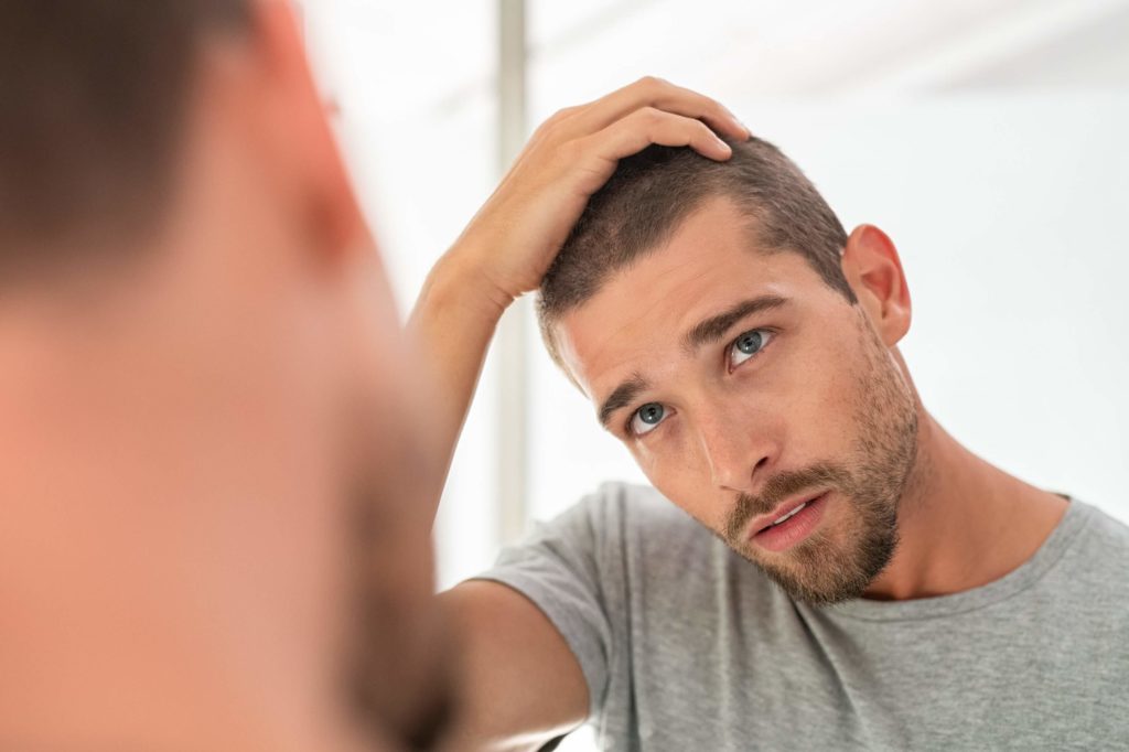 man checking head for hair loss